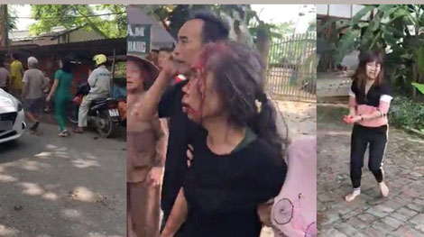 Con rể cũ chém mẹ vợ trọng thương