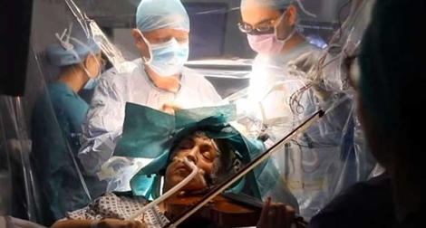 Trải qua phẫu thuật não trong khi chơi violin