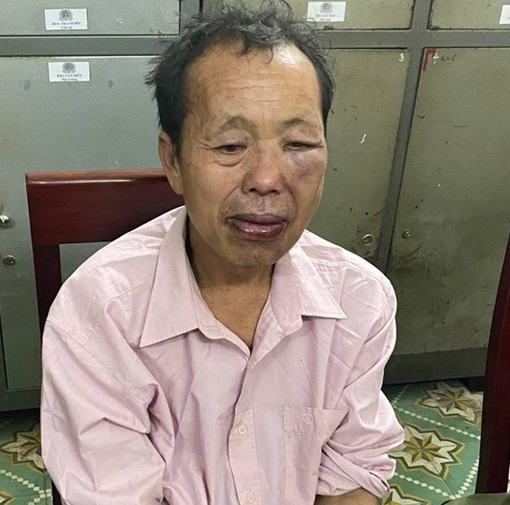 “Trùm” ma túy dùng súng và dao nhọn tấn công Cảnh sát