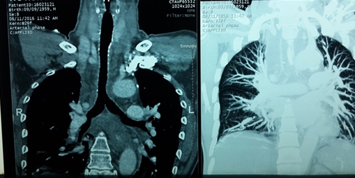 Cấp cứu và hỗ trợ bệnh nhân người Đài Loan về nước an toàn