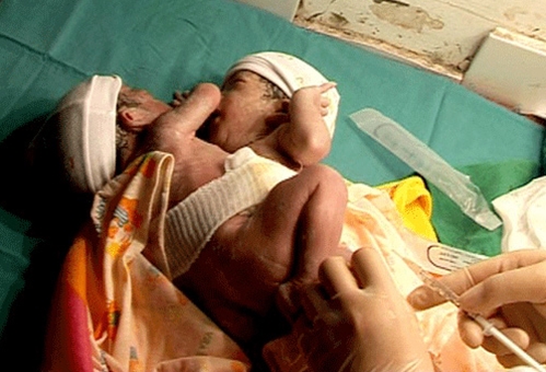 Khám sàng lọc trước và sau sinh hạn chế được tối đa các em bé dị tật ra đời