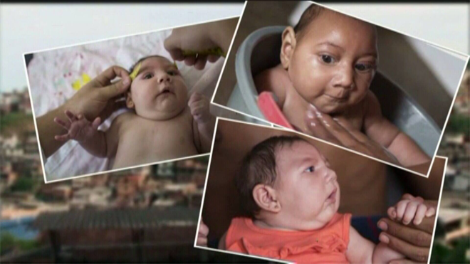 Nhiều người thờ ơ trước dịch Zika dù bệnh đầu nhỏ đã xuất hiện ở Việt Nam