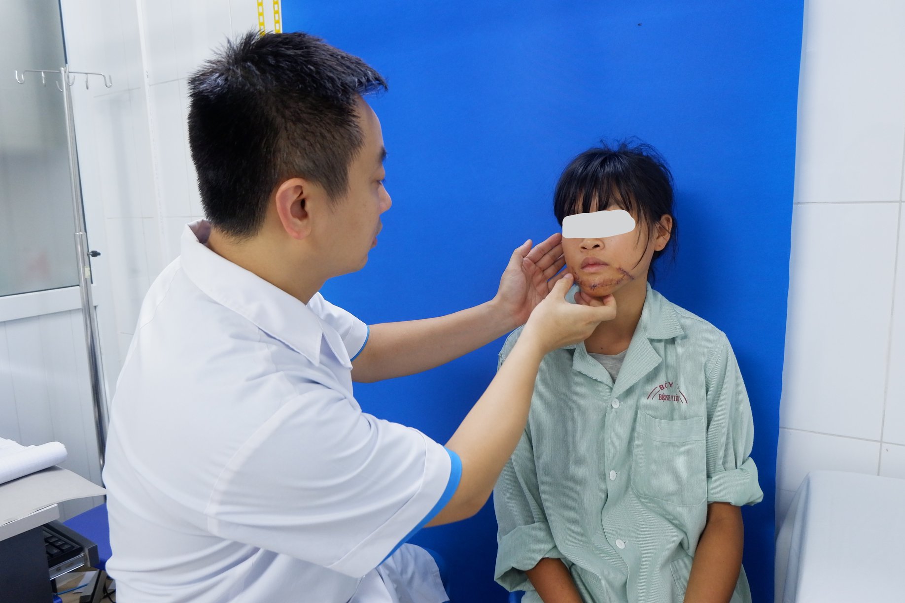 Phẫu thuật tạo hình mặt cho thiếu nữ bị sẹo do ngã vào bếp lửa