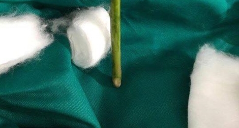 Suýt tử vong vì tự phá thai kiểu... lang băm