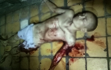 Ẩu đả sau bữa nhậu, 2 người thương vong