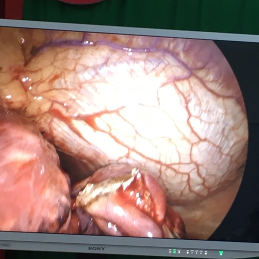 Bệnh viện Quân Y 175 tiếp nhận kỹ thuật cao cấp từ Nhật Bản