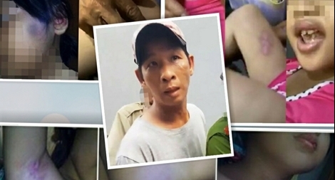 Gã nghiện mất nhân tính hành hạ con riêng của vợ