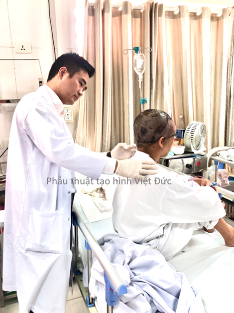 Quấn tóc vào máy làm sắt, nữ công nhân bị lột toàn bộ da đầu