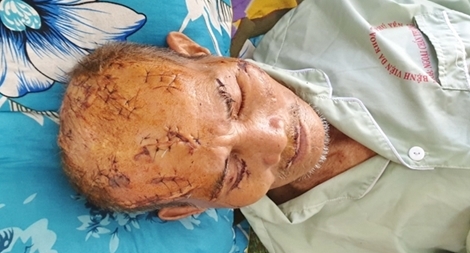 Nghi án cha bị con trai và cháu nội tấn công với 17 vết thương