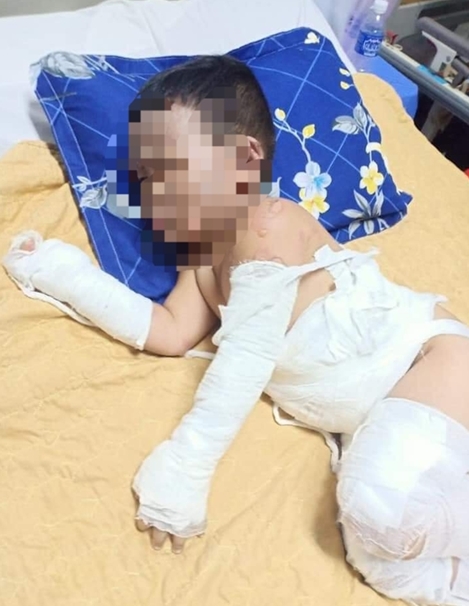 Nghi án ghen tuông phóng hỏa đốt kiốt, 2 bé trai bỏng nặng