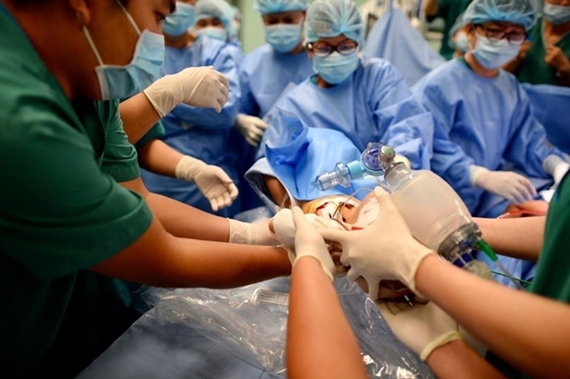 Hai bé song sinh đã tỉnh sau ca phẫu thuật tách dính