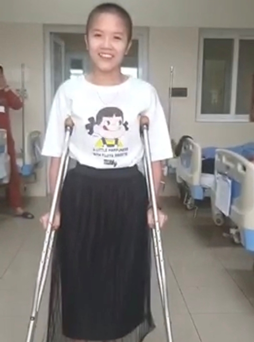 Thay xương đùi cho cô gái mắc ung thư