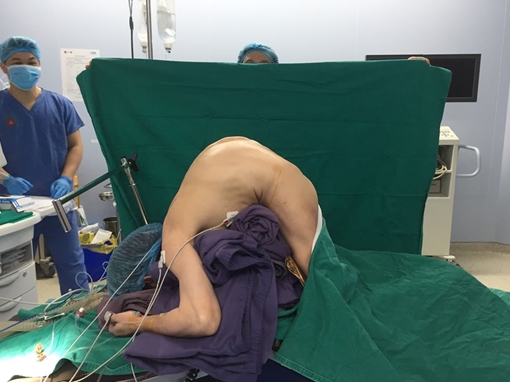 Phẫu thuật cứu bệnh nhân 'siêu gù' 10 năm không thể nằm ngửa