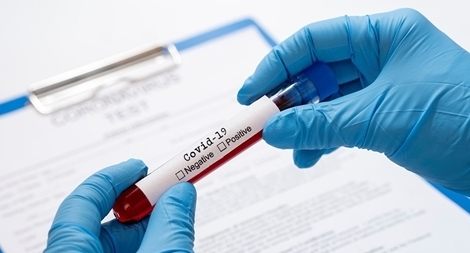 1 phụ nữ nhập cảnh dương tính với SARS-CoV-2 sau 3 lần xét nghiệm