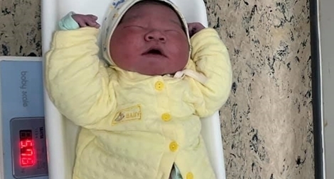 Bé trai gần 6kg chào đời tại BV Bệnh Nhiệt đới Trung ương