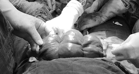 Làm rõ vụ thai nhi tử vong bất thường ở Kiên Giang