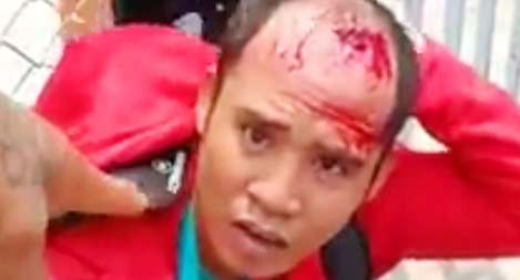 Chủ hiệu vàng mưu trí giả ngất tóm gọn tên cướp manh động