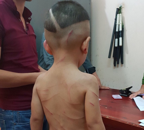 Đánh đập dã man con riêng của vợ chỉ vì quấy khóc
