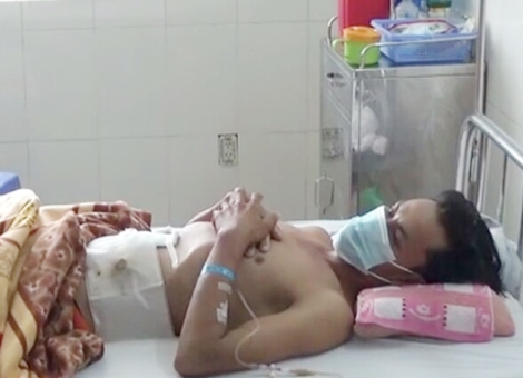 Người đàn ông bị lưỡi máy cắt cỏ đâm thủng bụng