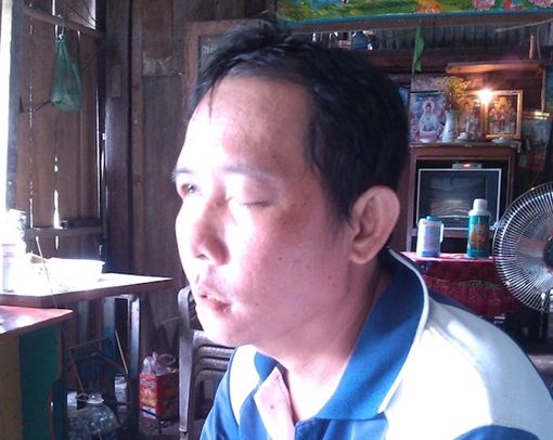 Bệnh nhân tố bác sĩ phòng khám nhổ răng dẫn đến mù mắt