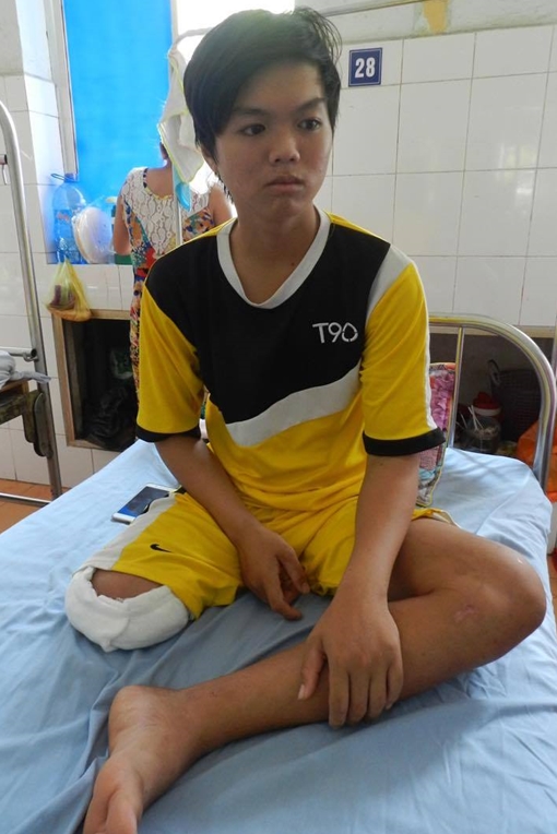 Bác sĩ hạn chế chuyên môn, bệnh nhân 16 tuổi phải tháo khớp gối