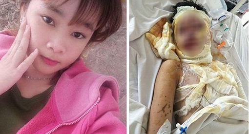 Đã bắt được nghi phạm tạt axit thiếu nữ và bạn gái