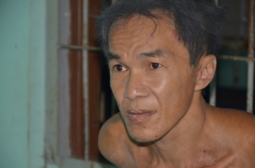 Kẻ “giết người phân xác” ở Sa Đéc mắc bệnh tâm thần