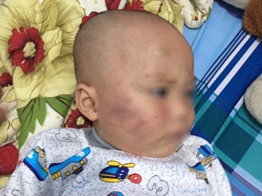 Xử lý nghiêm vụ bảo mẫu tát liên tục vào mặt bé trai 19 tháng tuổi