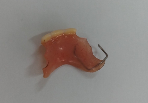 (Hy hữu) Ăn sáng, nuốt luôn hàm răng giả vào thực quản