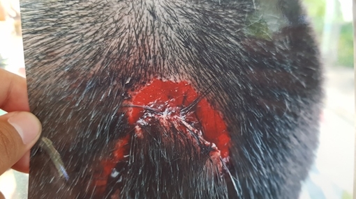 Xác minh vụ học sinh bị bạn đánh gây xôn xao ở Vĩnh Long