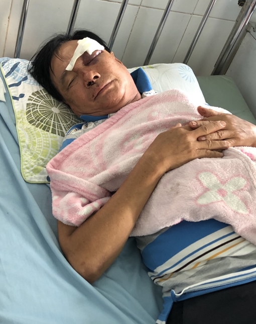 Con rể đánh bố vợ nhập viện cấp cứu