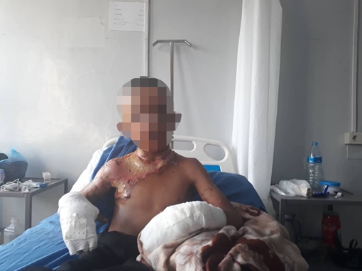 Thổ Nhĩ Kỳ bị tố dùng vũ khí hoá học tấn công người Kurd ở Syria